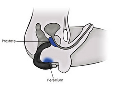 Массаж простаты схема